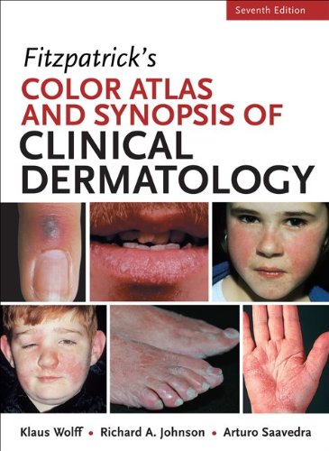 Fitzpatricks Color Atlas and Synopsis of Clinical Dermatology:   2013 9780071793025 Front Cover