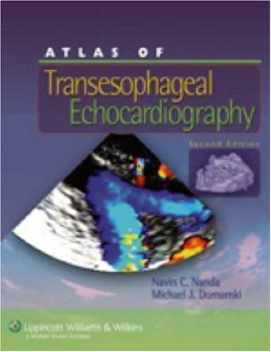 Atlas of Transesophageal Echocardiography  2nd 2007 (Revised) 9780781755030 Front Cover