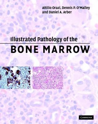 Illustrated Pathology of the Bone Marrow   2006 9780521810036 Front Cover