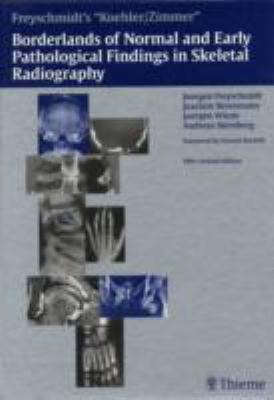 Freyschmidt's Koehler/Zimmer Borderlands of Normal and Early Pathological Findings in Skeletal Radiography  5th 2003 9783137841050 Front Cover