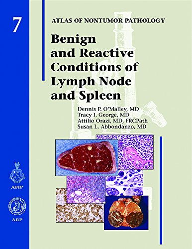 Benign and Reactive Conditions of Lymph Node and Spleen   2009 9781933477060 Front Cover