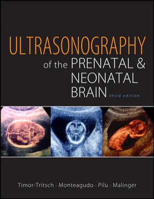 Ultrasonography of the Prenatal Brain, Third Edition  3rd 2012 9780071613064 Front Cover