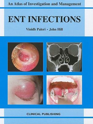 ENT Infections An Atlas of Investigation and Management  2010 9781846920066 Front Cover