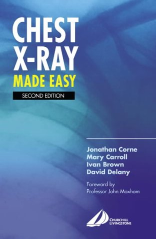 Chest X-Ray Made Easy  2nd 2002 (Revised) 9780443070082 Front Cover