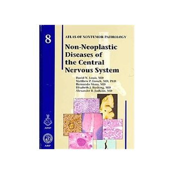 Non-Neoplastic Diseases of the Central Nervous System   2010 9781933477084 Front Cover