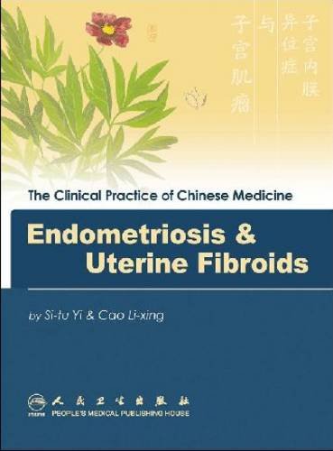 Endometriosis & Uterine Fibroids:   2008 9787117102087 Front Cover