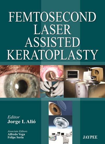 Femtosecond Laser Assisted Keratoplasty   2013 9789350905098 Front Cover