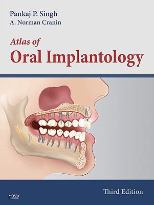 Atlas of Oral Implantology  3rd 2010 9780323045100 Front Cover
