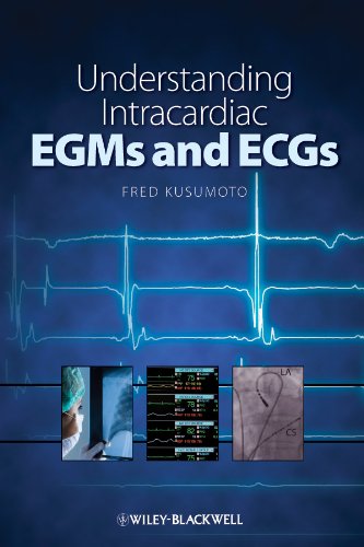 Understanding Intracardiac EGMs and ECGs   2010 9781405184106 Front Cover