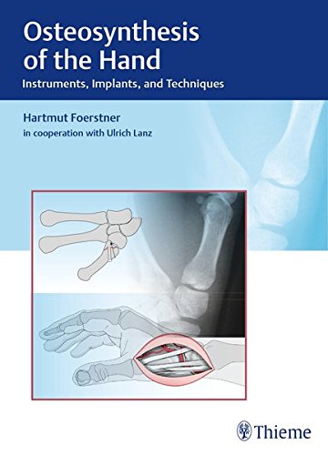 Osteosynthese der Hand   2017 9783132038110 Front Cover
