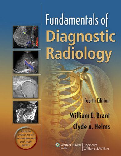 Fundamentals of Diagnostic Radiology  4th 2012 (Revised) 9781608319114 Front Cover