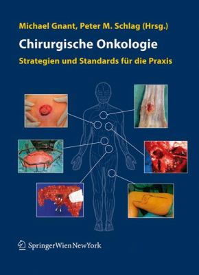 Chirurgische Onkologie Strategien und Standards Fï¿½r Die Praxis  2008 9783211486122 Front Cover