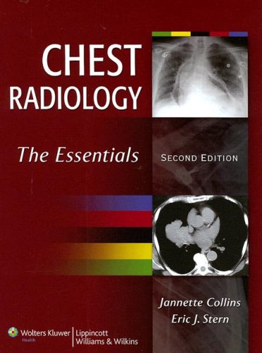 Chest Radiology The Essentials 2nd 2008 (Revised) 9780781763141 Front Cover