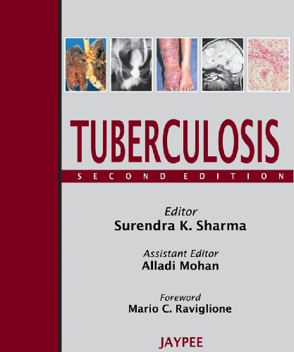 Tuberculosis:   2008 9788184485141 Front Cover