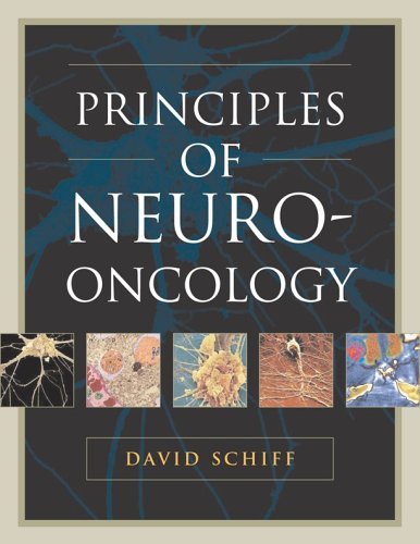 Principles of Neuro-Oncology   2005 9780071425155 Front Cover