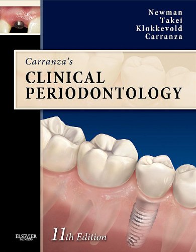 Carranza's Clinical Periodontology Expert Consult Text with Continually Updated Online Reference 11th 2012 9781437704167 Front Cover
