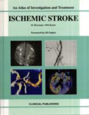 Stroke: An Atlas of Investigation and Diagnosis  2008 9781846920172 Front Cover
