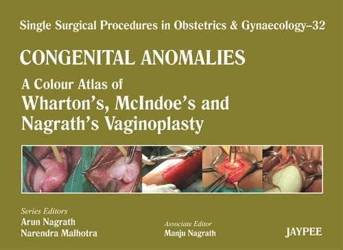 Single Surgical Procedures in Obstetrics and Gynaecology: Volume 32: Congenital Anomalies A Colour Atlas of Wharton's, Mcindoe's and Nagrath's Vaginoplasty  2013 9789350905173 Front Cover