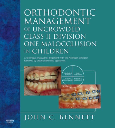 Orthodontic Management of Uncrowded Class II Division One Malocclusion in Children   2006 9780323053174 Front Cover