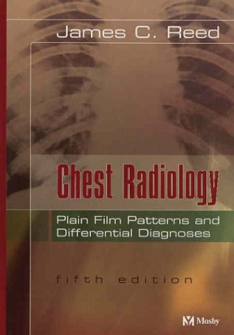 Chest Radiology Plain Film Patterns and Differential Diagnoses 5th 2003 (Revised) 9780323026178 Front Cover