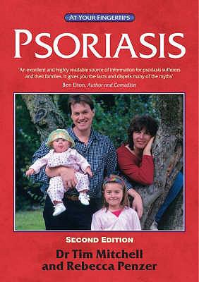 Psoriasis  2005 9781859591178 Front Cover