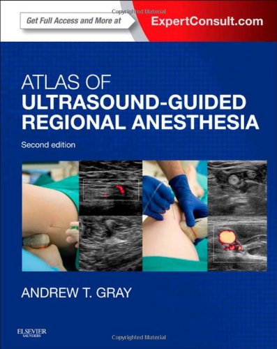 Atlas of Ultrasound-Guided Regional Anesthesia Expert Consult - Online and Print 2nd 2013 9781455728183 Front Cover