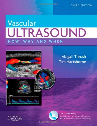 Vascular Ultrasound How, Why and When 3rd 2010 9780443069185 Front Cover