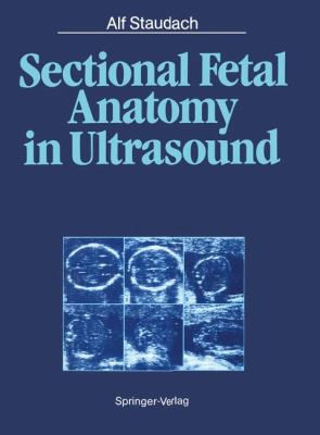 Sectional Fetal Anatomy in Ultrasound   1987 9783642729188 Front Cover