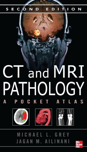 CT and MRI Pathology  2nd 2012 9780071703192 Front Cover