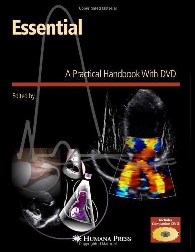 Essential Echocardiography A Practical Handbook  2007 9781588293220 Front Cover