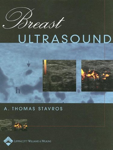 Breast Ultrasound  2nd 2004 9780397516247 Front Cover