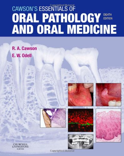 Cawson's Essentials of Oral Pathology and Oral Medicine  8th 2008 9780443101250 Front Cover