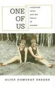 One of Us Conjoined Twins and the Future of Normal  2004 9780674018259 Front Cover