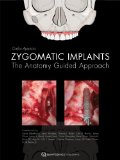 Zygomatic Implants: The Anatomy Guided Approach  2012 9781850972259 Front Cover