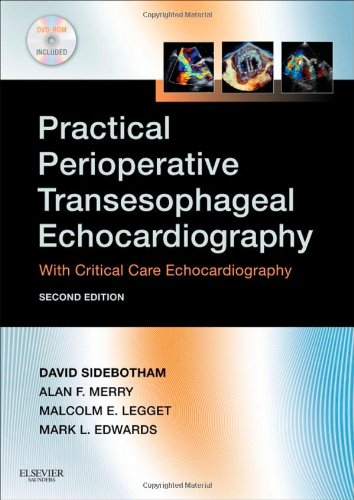 Practical Perioperative Transesophageal Echocardiography Text with DVD-ROM 2nd 2011 9780702034275 Front Cover