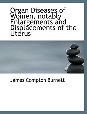 Organ Diseases of Women, Notably Enlargements and Displacements of the Uterus  N/A 9781115080279 Front Cover