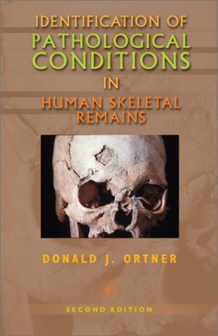 Identification of Pathological Conditions in Human Skeletal Remains  2nd 2003 (Revised) 9780125286282 Front Cover