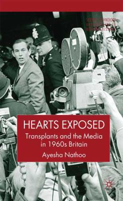 Hearts Exposed Transplants and the Media in 1960s Britain  2009 9781403987303 Front Cover