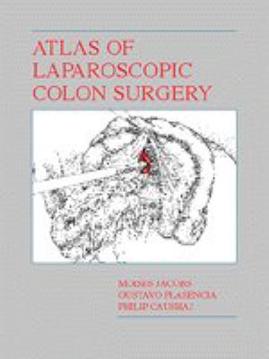 Atlas of Laparoscopic Colon Surgery   1996 9780683300321 Front Cover
