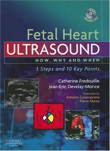 Fetal Heart Ultrasound   2007 9780443103322 Front Cover