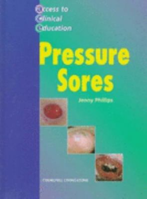 Pressure Ulcers   1997 9780443055324 Front Cover