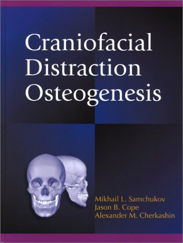 Craniofacial Distraction Osteogenesis   2001 9780323011341 Front Cover