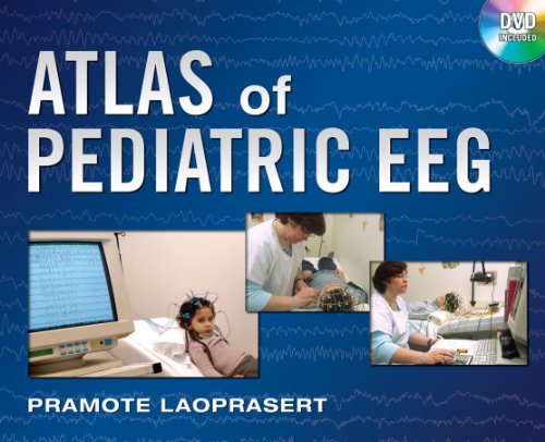 Atlas of Pediatric EEG   2011 9780071623346 Front Cover
