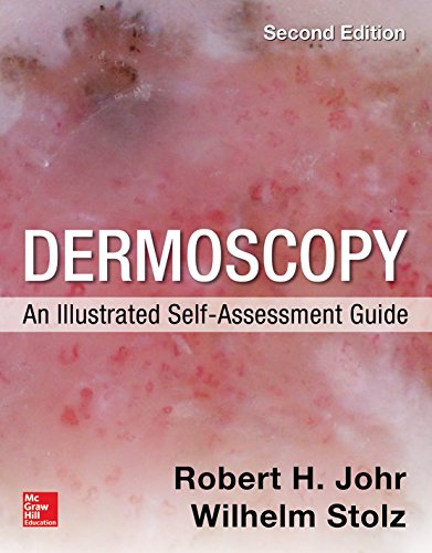 Dermoscopy: An Illustrated Self-assessment Guide  2015 9780071834346 Front Cover