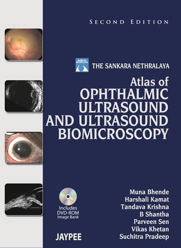 Atlas of Ophthalmic Ultrasound and Ultrasound Biomicroscopy  2nd 2013 (Revised) 9789350905357 Front Cover
