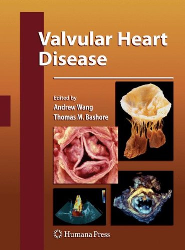 Valvular Heart Disease:   2012 9781617796364 Front Cover