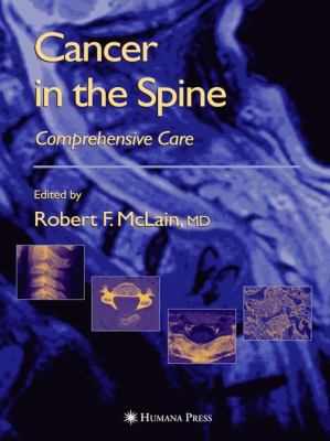 Cancer in the Spine Comprehensive Care  2006 9781617373404 Front Cover