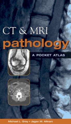 CT and MRI Pathology A Pocket Atlas  2003 9780071380409 Front Cover