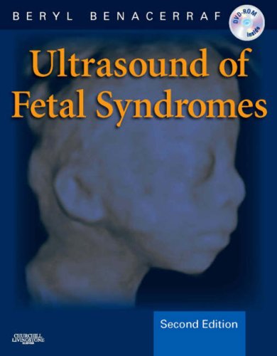 Ultrasound of Fetal Syndromes Text with DVD 2nd 2008 (Revised) 9780443066412 Front Cover
