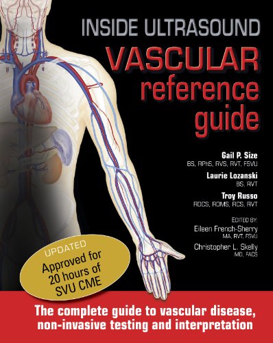 Inside Ultrasound Vascular Reference Guide  N/A 9780974769431 Front Cover
